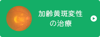 加齢黄斑変性 の治療